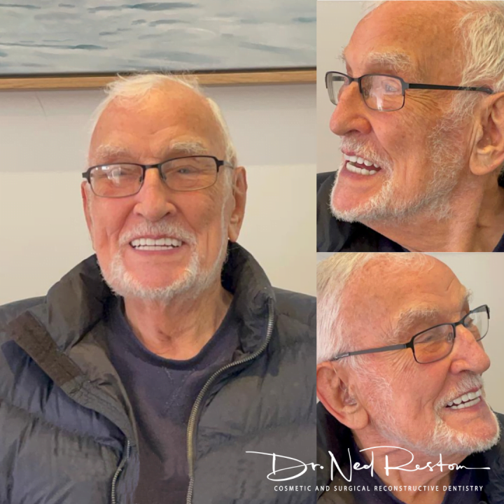 Ned Restom -  Smile On Clinics - Teeth on Implants
